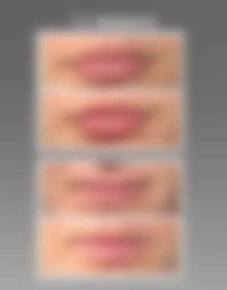 Lip Oasis Glossy Treatment in Clear
